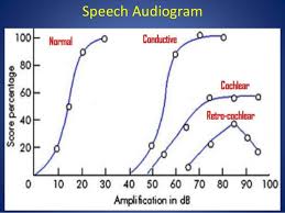 Speech Audiometry